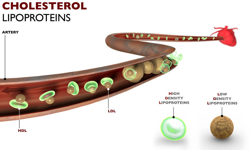 Cholesterol, fat formation, artery, heart. HDL are lipoproteins Cholesterol, fat formation, artery, heart. HDL are lipoproteins
