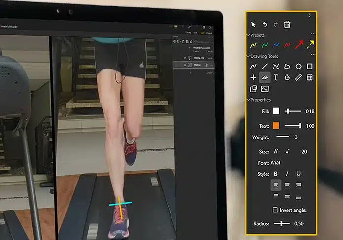 Dartfish Gait analysis Dartfish Gait analysis